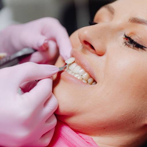 Facetas e Lentes de Contato Dental  por Floreli Centro Integrado em Odontologia