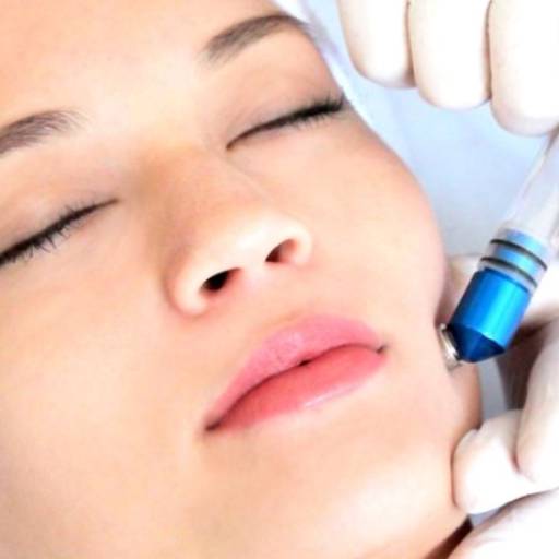 Peeling Diamante por Centro de Estética Depil’ Arte