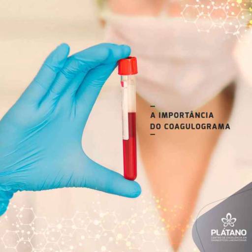 Comprar o produto de Exame de Coagulograma em Exames  pela empresa Vitagen Laboratório de Análises Clínicas  em Foz do Iguaçu, PR por Solutudo