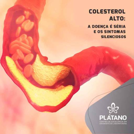 Comprar o produto de Exames de Colesterol em Exames  pela empresa Vitagen Laboratório de Análises Clínicas  em Foz do Iguaçu, PR por Solutudo