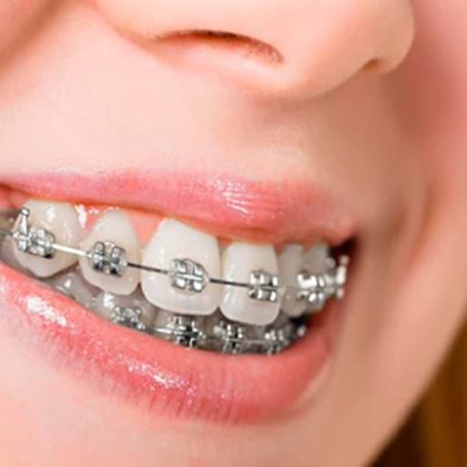 Comprar o produto de Ortodontia em Bauru em Odontologia pela empresa Oral Sin Implantes em Bauru, SP por Solutudo