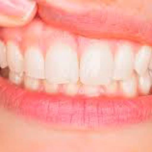 Comprar o produto de Periodontia em Bauru em Odontologia pela empresa Oral Sin Implantes em Bauru, SP por Solutudo