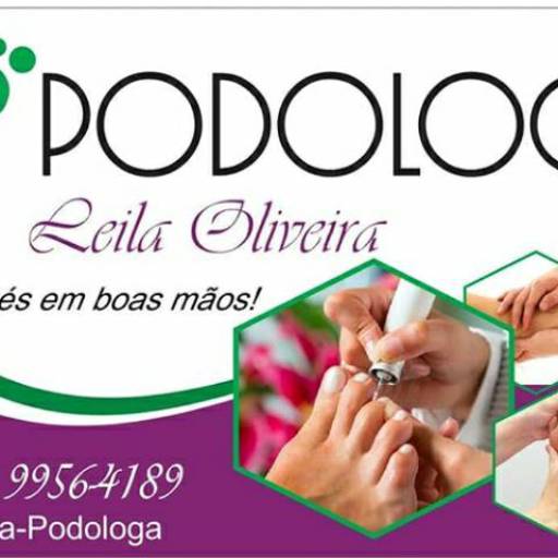 Comprar o produto de Tratamento de Unha com micose em Outros pela empresa Podologia - Leila Oliveira em Mineiros, GO por Solutudo