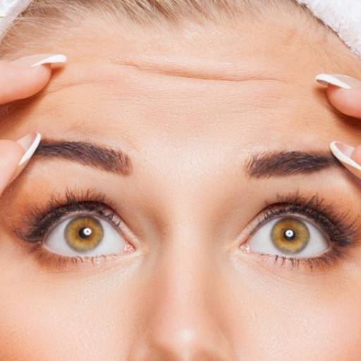 Botox por Janaina Leite De Moraes