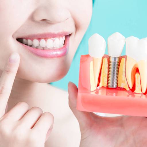 Comprar o produto de Implantodontia em Especialidades pela empresa CIOF Odontologia • Dentista em Atibaia em Atibaia, SP por Solutudo