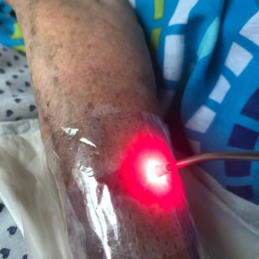 Laserterapia e a PDT (terapia fotodinâmica antimicrobiana)