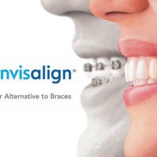 Comprar o produto de Alinhadores invisíveis Invisalign em Saúde Dental pela empresa Clínica de Ortodontia Dra. Eliana de Souza  em Araçatuba, SP por Solutudo