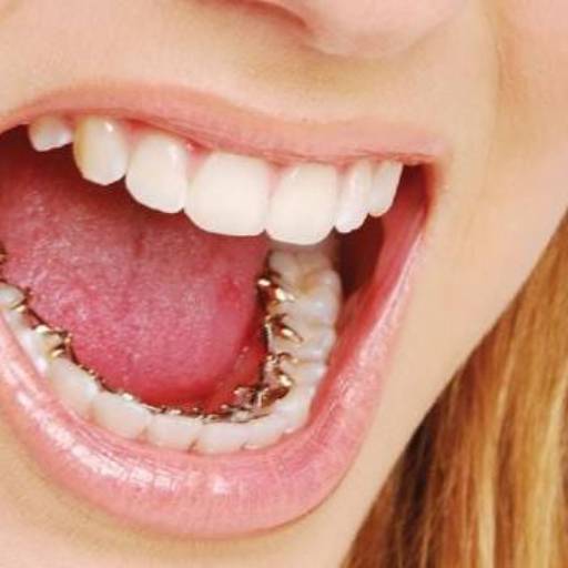 Ortodontia Lingual por Clínica de Ortodontia Dra. Eliana de Souza 