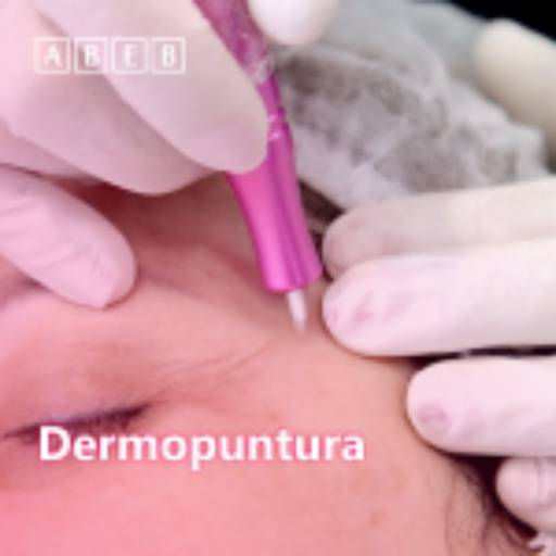 Dermopuntura por ABEB - Academia Brasileira De Estética e Beleza