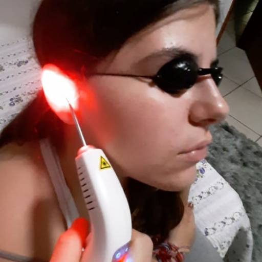 Auriculoterapia em Jundiaí, SP por Renata Finkler Auriculoterapia