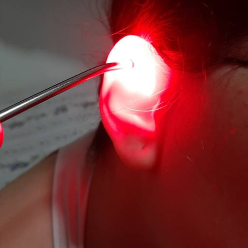 Auriculoterapia em Jundiaí, SP por Renata Finkler Auriculoterapia