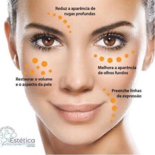 Preenchimento Labial