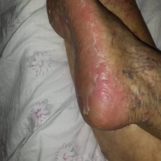 Rénover Gomage por Suprimentos Vieira