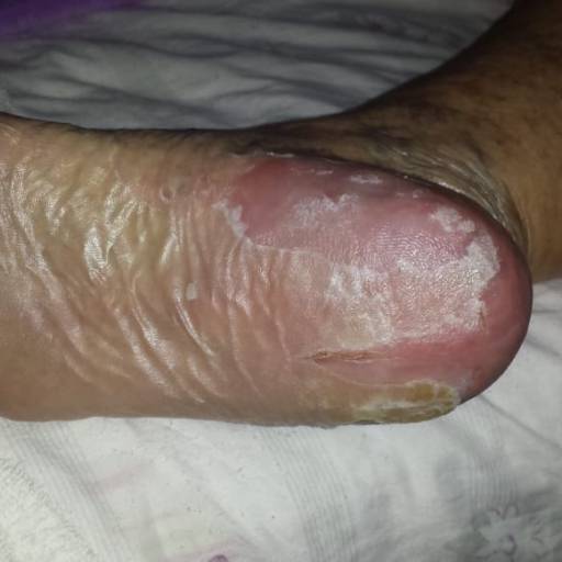 Rénover Gomage por Suprimentos Vieira