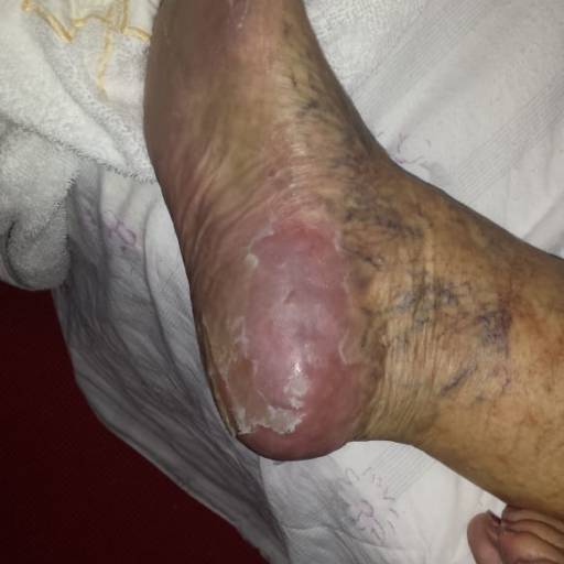 Rénover Gomage por Suprimentos Vieira