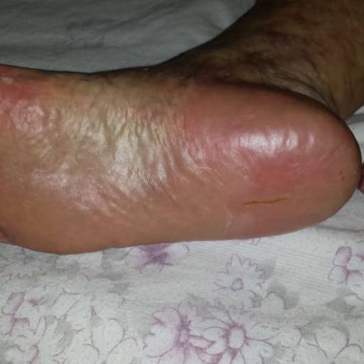 Rénover Gomage por Suprimentos Vieira