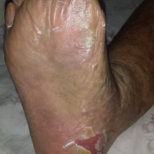 Rénover Gomage por Suprimentos Vieira