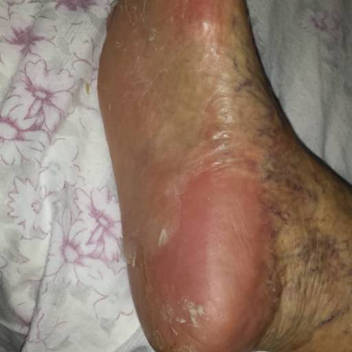 Rénover Gomage por Suprimentos Vieira