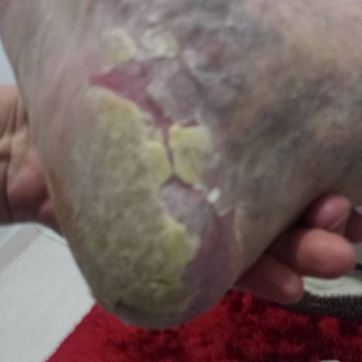 Rénover Gomage por Suprimentos Vieira