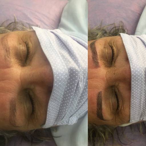 Micropigmentação por Academia Dos Fios