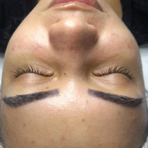 Comprar o produto de Redução de Poros em Estética Facial pela empresa Rosana Fernandes - Especialista em Limpeza de Pele (Studio R) em Jaboticabal, SP por Solutudo