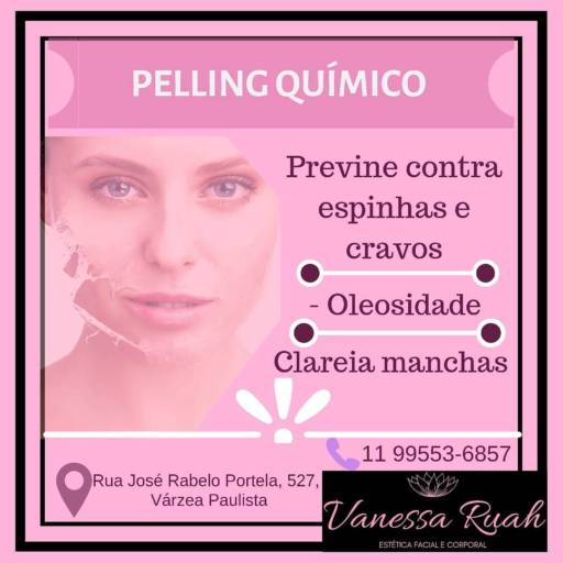 Pelling Químico por Vanessa Ruah