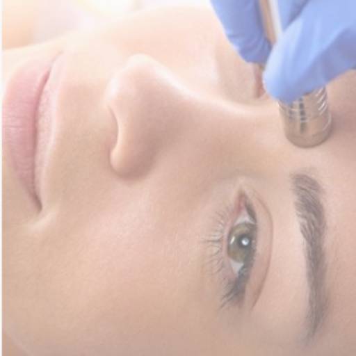 Peeling de Diamante por Analaser Depilação a Laser e Estética
