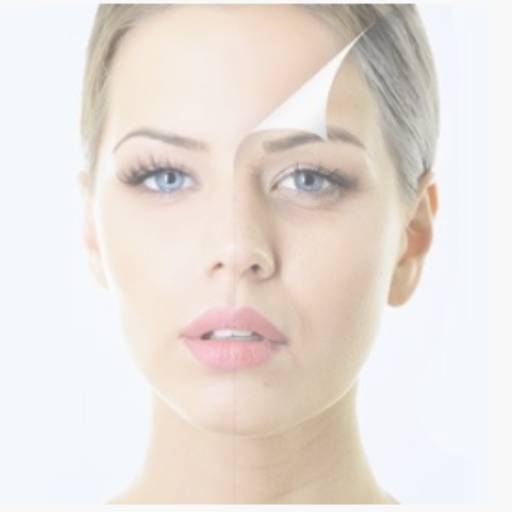 Peeling de Porcelana por Analaser Depilação a Laser e Estética