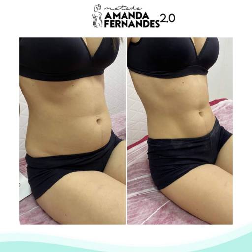 Drenagem linfática Método Amanda Fernandes 