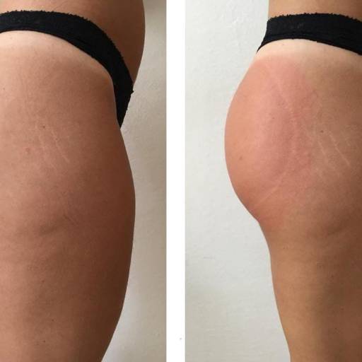 Bumbum Na Nuca Pump Up