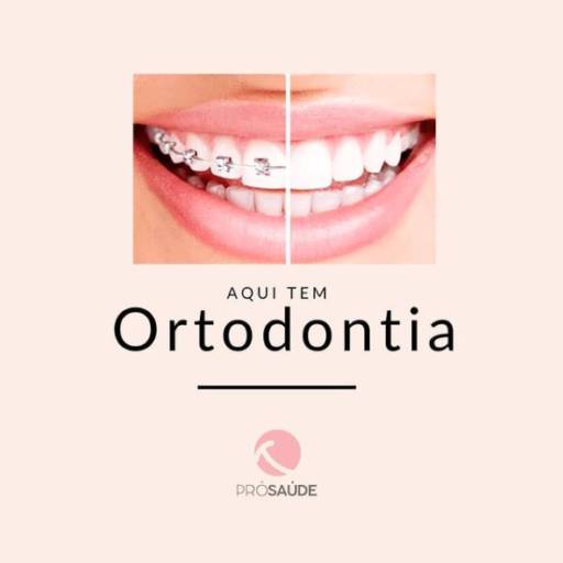 Comprar o produto de Aparelho Ortdôntico em Odontologia pela empresa Clínica Pró Saúde em São Manuel, SP por Solutudo