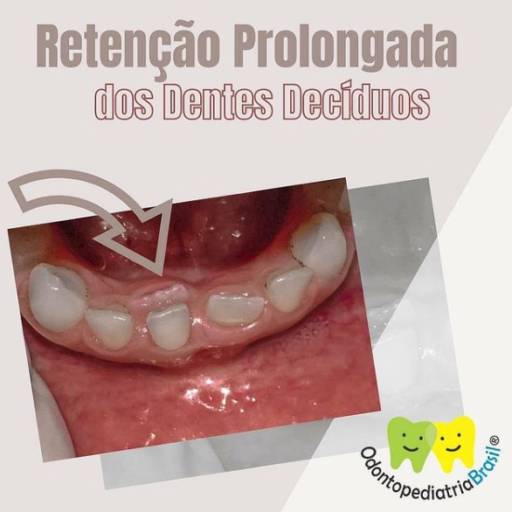 Porque a Saúde começa na BOCA!!! por Chalhoub Odontologia