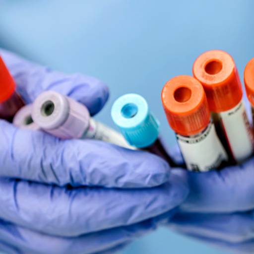 Tipagem Sanguínea  por Laboratorio Bioexames