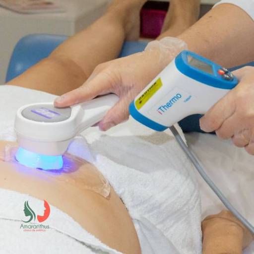 Radiofrequência por Clinica de Estética Rosana Pontes