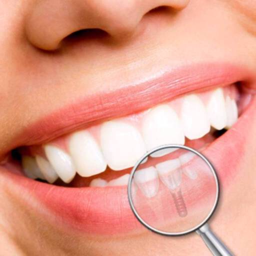 Comprar o produto de Implante Dentário em Tratamento Dentário pela empresa Clínica Sorriso - Nossa Senhora do Socorro em Aracaju, SE por Solutudo