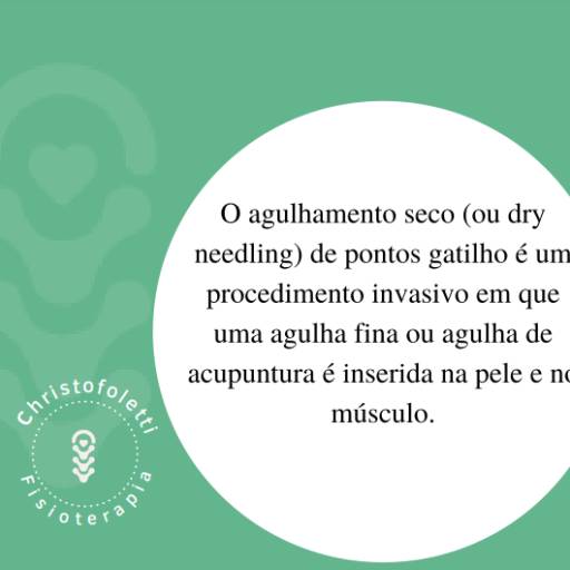 Dry Needling por Clínica Christofoletti Fisioterapia Estética Pilates