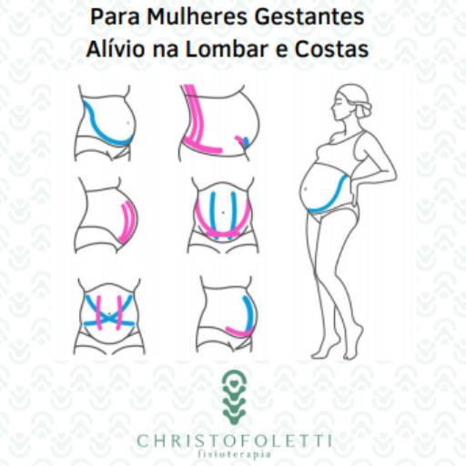 Para Mulheres Gestantes Alívio na Lombar e Costas - Dr.ª Paula Christofoletti por Clínica Christofoletti Fisioterapia Estética Pilates