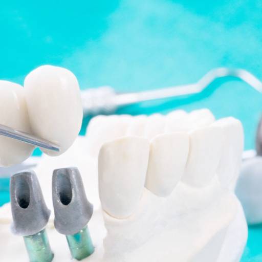Comprar o produto de Implante Dentário em Estética Odontológica pela empresa Miarelli - Consultório Odontológico Especializado em Jundiaí, SP por Solutudo