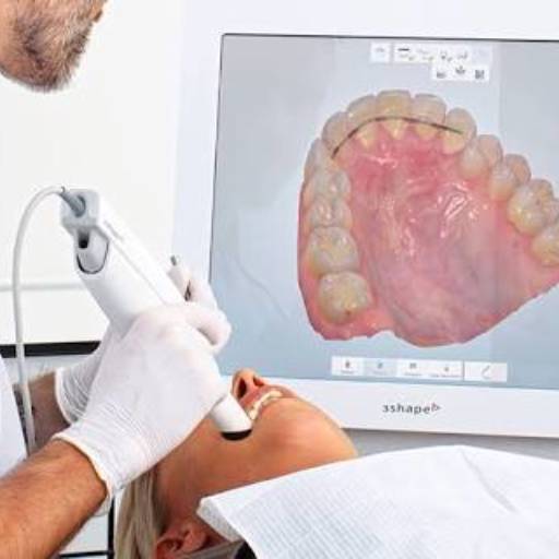Escaneamento Intra Oral por Contraste Radiologia Digital