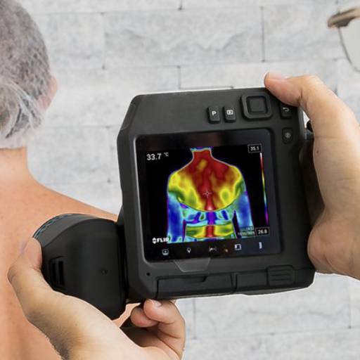 Termografia