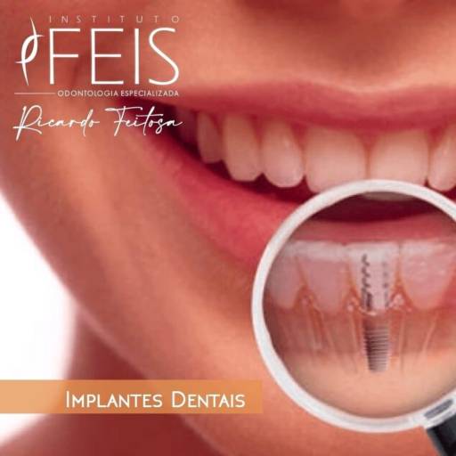 Implantes Dentais  por Instituto Feis - RT Dr. Ricardo Feitosa CRO-SP 77583