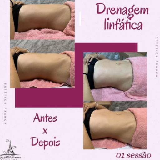 Pós Operatório por Estética França