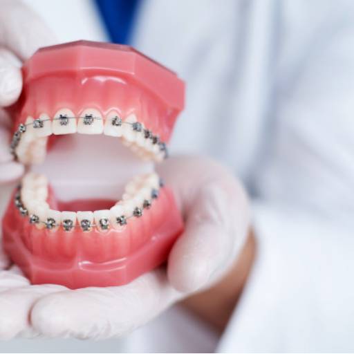 Ortodontia por Cuesta Odonto