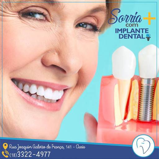 Implantes por Clínica Odontológica Cimó 