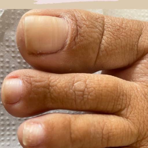 Comprar o produto de Exame dos pés para identificar patologias em Manicures e Pedicures pela empresa Ângela Cardoso Podologa em Marília, SP por Solutudo