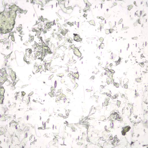 Parasitológico de raspado cutâneo