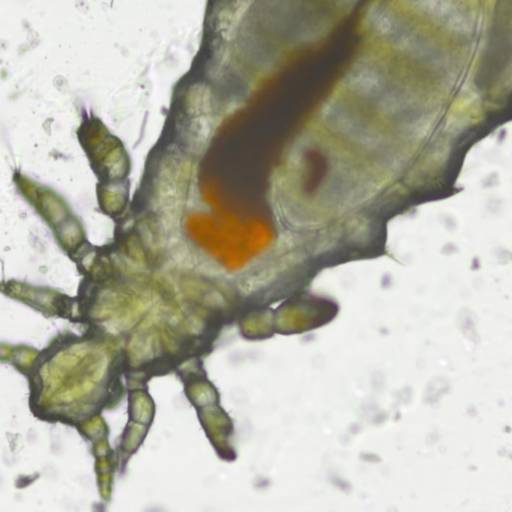 Parasitológico de raspado cutâneo