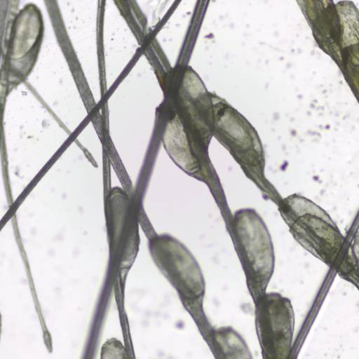 Parasitológico de raspado cutâneo