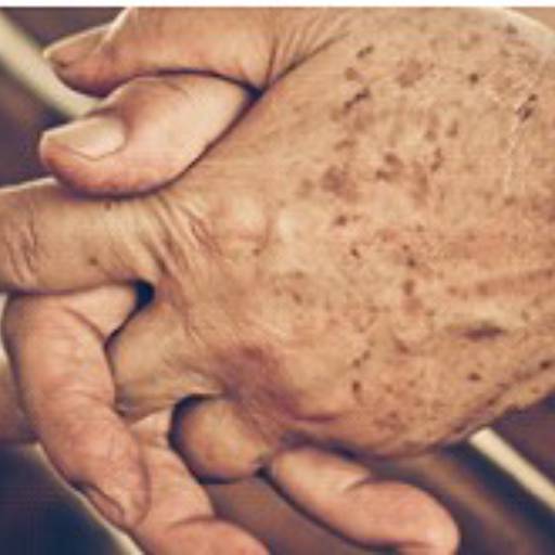 JATO DE PLASMA PURO por Centro Estético Anita Lopes