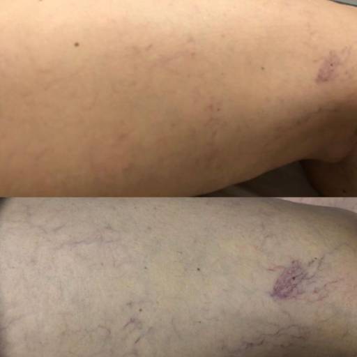 Estética Facial  por Beleza e Estética Jeane Lima - Esteticista